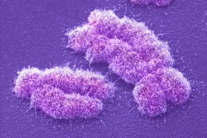 X & Y Chromosomes